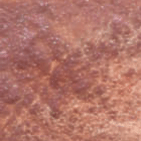 Burnt Bronzite Genuine